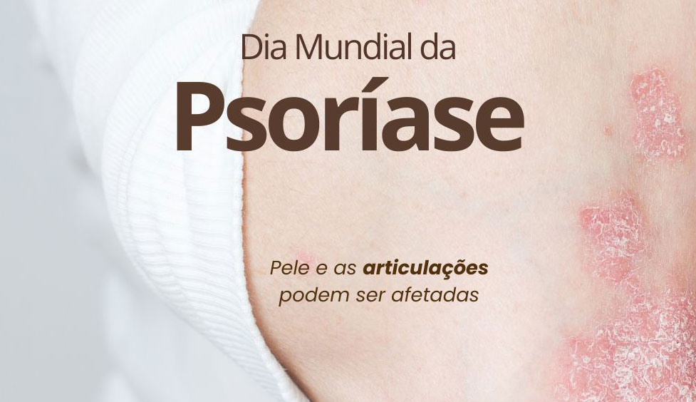 Dia Mundial da Psoríase