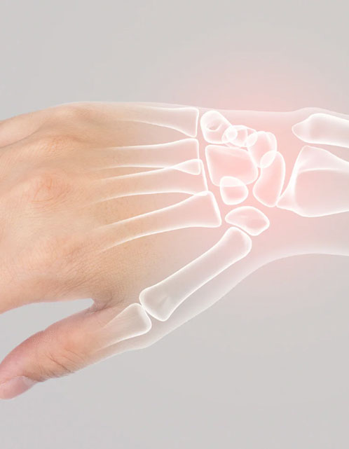 Suspeita de falta de cálcio: saiba quais são os principais sintomas | Reumatologista em Campinas – Cambuí