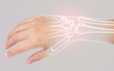 Suspeita de falta de cálcio: saiba quais são os principais sintomas