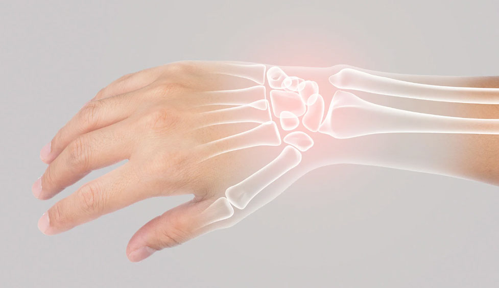 Suspeita de falta de cálcio: saiba quais são os principais sintomas